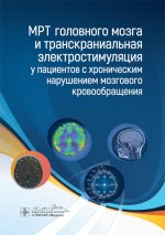 МРТ головного мозга и транскраниальная электростимуляция у пациентов с хроническим нарушением мозгового кровообращения