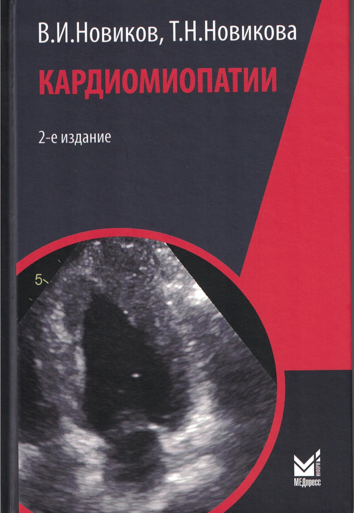 Кардиомиопатии