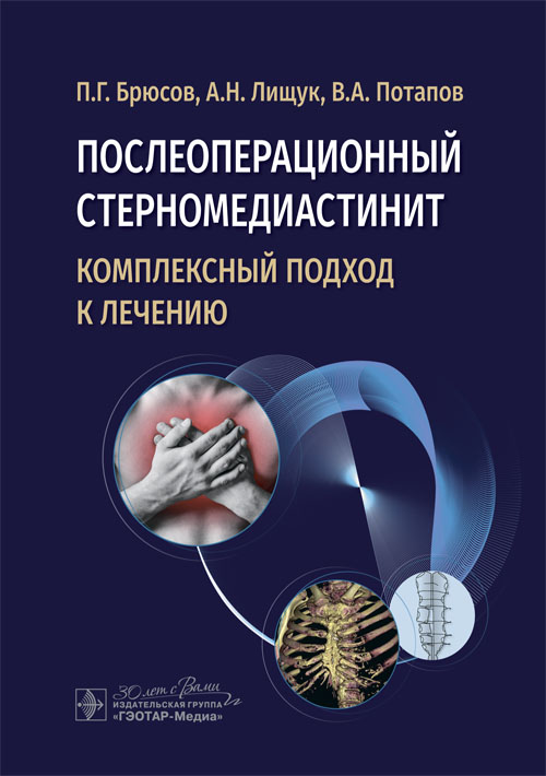 Послеоперационный стерномедиастинит. Комплексный подход к лечению