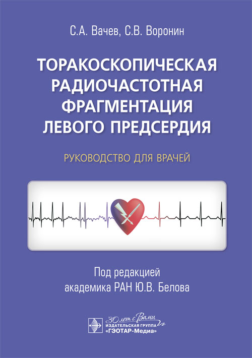 Торакоскопическая радиочастотная Фрагментация левого предсердия