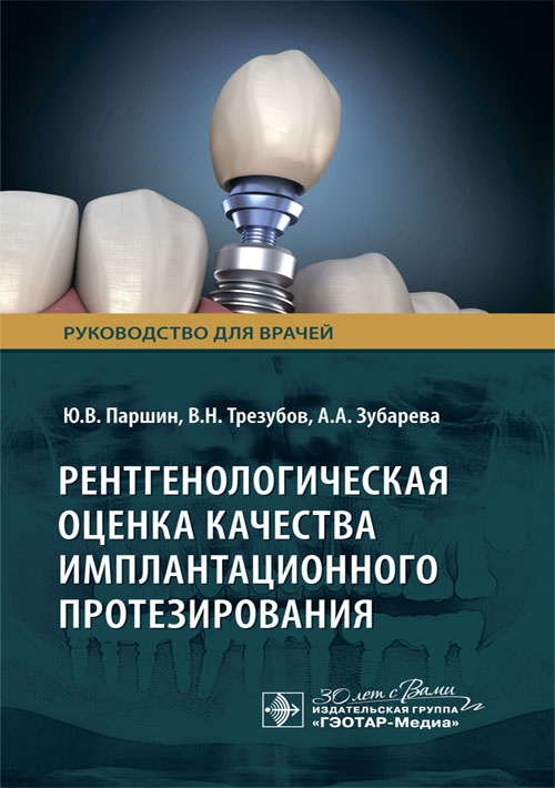 Рентгенологическая оценка качества имплантационного протезирования : руководство для врачей / Ю. В. Паршин, В. Н. Трезубов, А. А. Зубарева [и др.]. — Москва : ГЭОТАР-Медиа, 2024. — 48 с. : ил