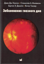 Заболевания глазного дна