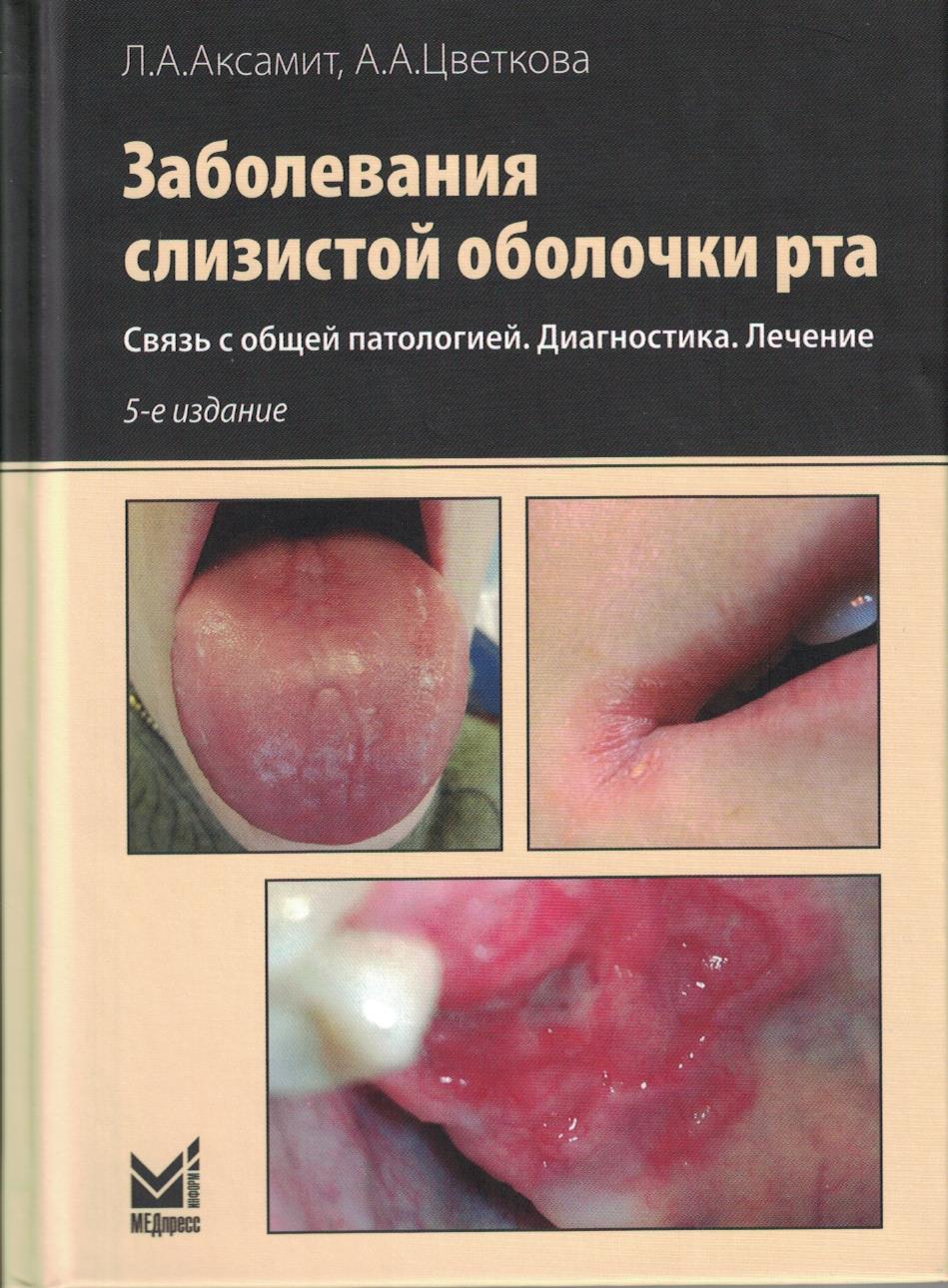 Заболевания слизистой оболочки рта. Связь с общей патологией