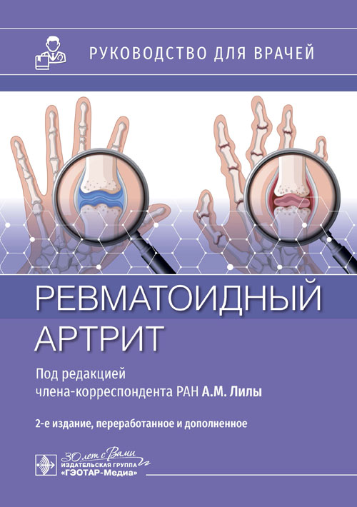 Ревматоидный артрит