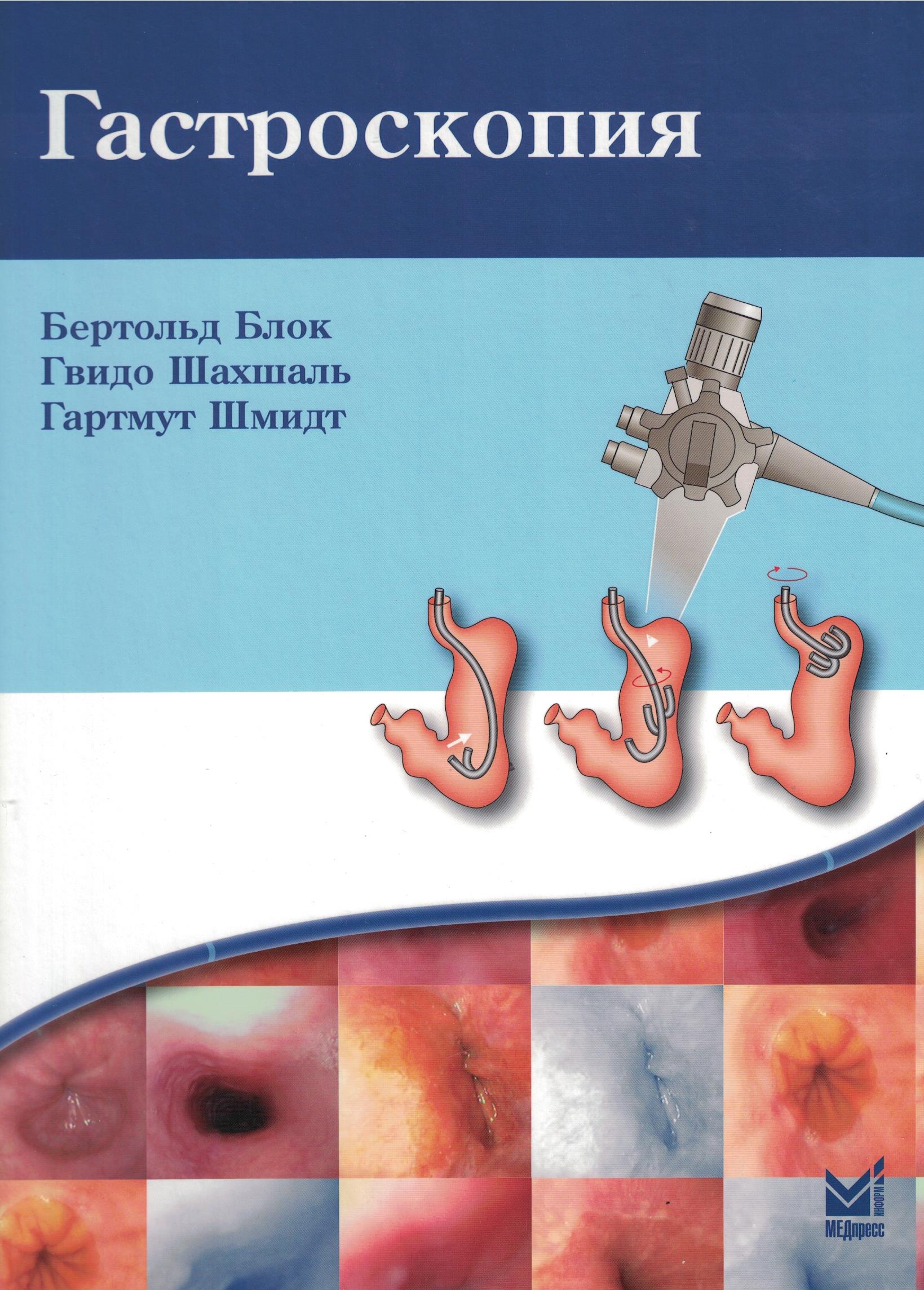 Гастроскопия