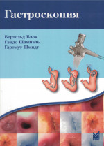Гастроскопия