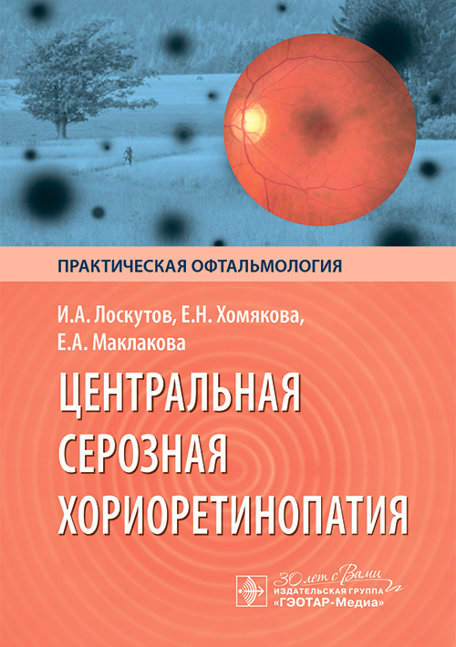 Центральная серозная хориоретинопатия