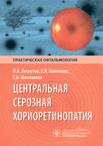 Центральная серозная хориоретинопатия