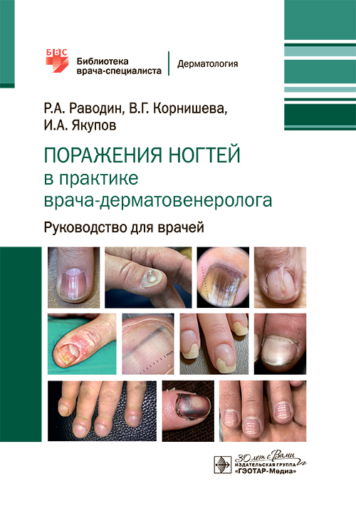 Поражения ногтей в практике врача-дерматовенеролога: руководство для врачей