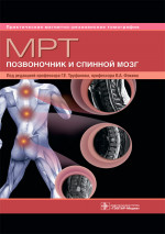 МРТ.Позвоночник и спинной мозг
