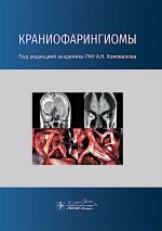 Краниофарингиомы / под ред. А. Н. Коновалова. — Москва : ГЭОТАР-Медиа, 2025. — 160 с. : ил
