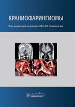Краниофарингиомы / под ред. А. Н. Коновалова. — Москва : ГЭОТАР-Медиа, 2025. — 160 с. : ил