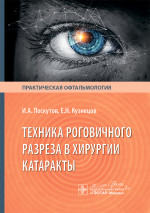 Техника роговичного разреза в хирургии катаракты / И. А. Лоскутов, Е. Н. Кузнецов. — Москва : ГЭОТАР-Медиа, 2025. — 144 с. : ил. — (Серия «Практическая офтальмология»)