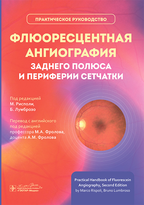 Флюоресцентная ангиография заднего полюса и периферии сетчатки: практическое руководство