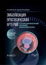 Эмболизация простатических артерий в лечении доброкачественной гиперплазии предстательной железы : руководство для врачей