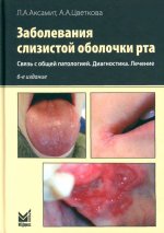 Заболевания слизистой оболочки рта