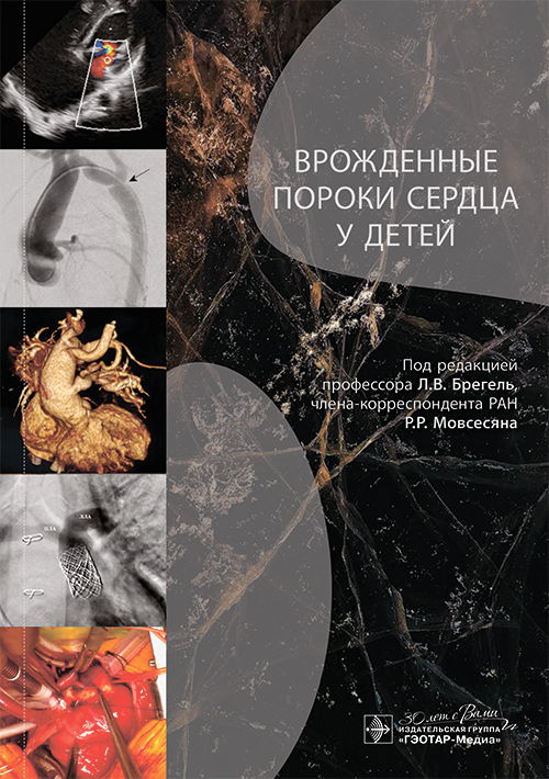 Врожденные пороки сердца у детей: руководство для врачей