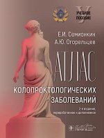 Атлас колопроктологических заболеваний
