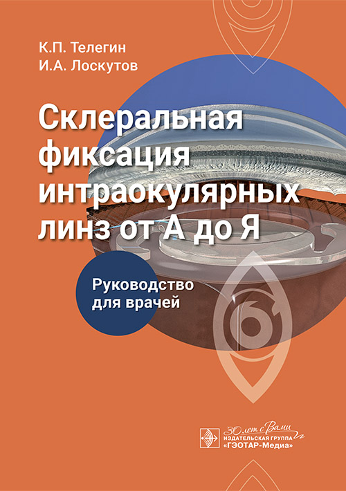 Склеральная фиксация интраокулярных линз от А до Я : руководство для врачей / К. П. Телегин, И. А. Лоскутов, О. А. Абашева. — Москва : ГЭОТАР-Медиа, 2025. — 168 с. : ил