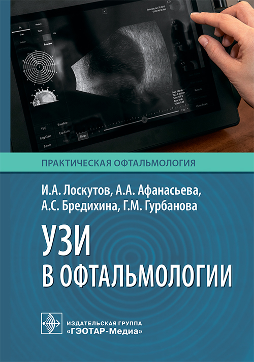 УЗИ в офтальмологии / И. А. Лоскутов, А. А. Афанасьева, А. С. Бредихина, Г. М. Гурбанова. — Москва : ГЭОТАР- Медиа, 2026. — 112 с. : ил. — (Серия «Практическая офтальмология»)