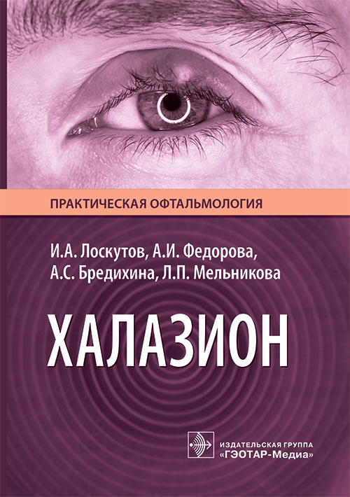 Халазион / И. А. Лоскутов, А. И. Федорова, А. С. Бредихина, Л. П. Мельникова. — Москва : ГЭОТАР-Медиа, 2026. — 112 с. : ил. — (Серия «Практическая офтальмология»)