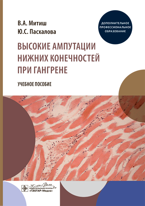 Высокие ампутации нижних конечностей при гангрене. Учебное пособие (эл.версия)