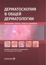 Дерматоскопия в общей дерматологии / под ред. А. Лалласа, Э. Эрричетти, Д. Йоаннидиса ; пер. с англ. под ред. Н. Н. Потекаева, А. В. Миченко. — Москва : ГЭОТАР-Медиа, 2026. — 392 с