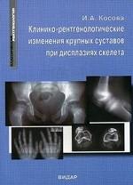 Клинико-рентгенологические изменения крупных суставов при дисплазиях скелета
