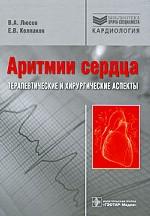 Аритмии сердца