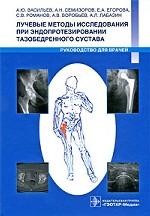 Лучевые методы исследования при эндопрот. тазобедр. сустава