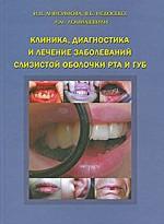 Клиника, диагностика и лечение заболеваний слизистой оболочки рта и губ