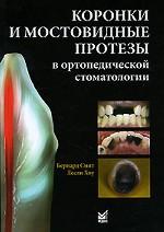 Коронки и мостовидные протезы в ортопедической стоматологии