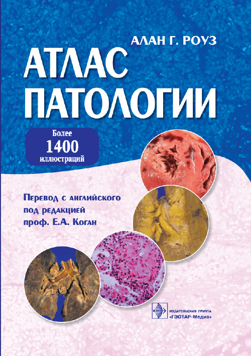 Атлас патологии. Макро- и микроскопические изменения органов