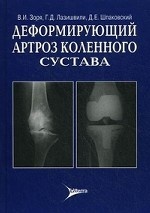 Деформирующий артроз коленного сустава