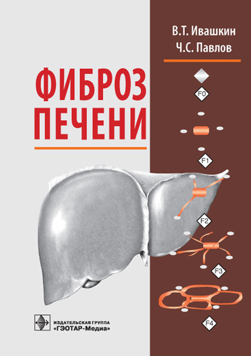 Фиброз печени. Монография
