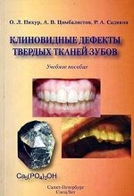 Клиновидные дефекты твердых тканей зубов: учебное пособие