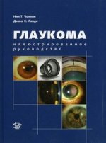 Глаукома: иллюстрированное руководство   