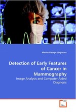 Detection of Early Features of Cancer in  Mammography. Image Analysis and Computer Aided Diagnosis