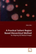 A Practical Salient Region Based Hierarchical Method. for Aligning 3D Medical Images