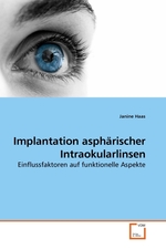 Implantation asphaerischer Intraokularlinsen. Einflussfaktoren auf funktionelle Aspekte