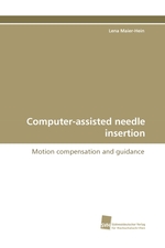 Computer-assisted needle insertion. Motion compensation and guidance