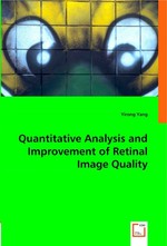 Quantitative Analysis and Improvement of Retinal Image Quality