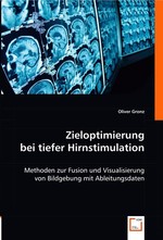 Zieloptimierung bei tiefer Hirnstimulation. Methoden zur Fusion und Visualisierung von Bildgebung mit Ableitungsdaten