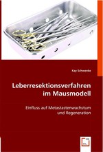 Leberresektionsverfahren im Mausmodell. Einfluss auf Metastastenwachstum und Regeneration