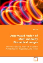 Automated Fusion of Multi-modality Biomedical Images. A Novel Automated Approach of Control Point Detection, Registration, and Fusion