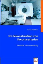 3D-Rekonstruktion von Koronararterien. Methodik und Anwendung
