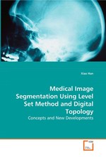 Medical Image Segmentation Using Level Set Method and Digital Topology. Concepts and New Developments