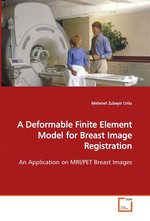 A Deformable Finite Element Model for Breast Image Registration. An Application on MRI/PET Breast Images