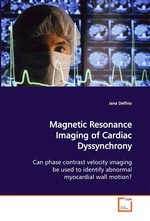 Magnetic Resonance Imaging of Cardiac Dyssynchrony. Can phase contrast velocity imaging be used to identify abnormal myocardial wall motion?