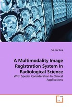 A Multimodality Image Registration System In Radiological Science. With Special Consideration In Clinical Applications